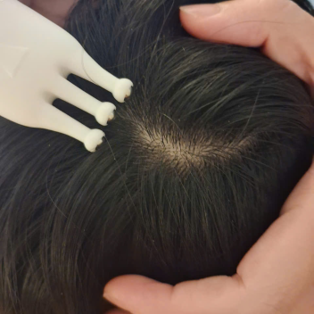 CHĂM SÓC TÓC - HỖ TRỢ MỌC TÓC (45 phút)